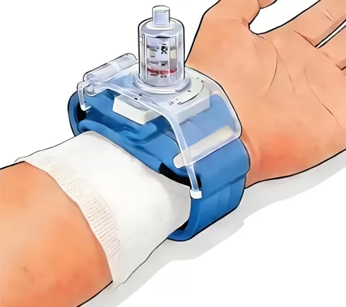 hemostatic valve